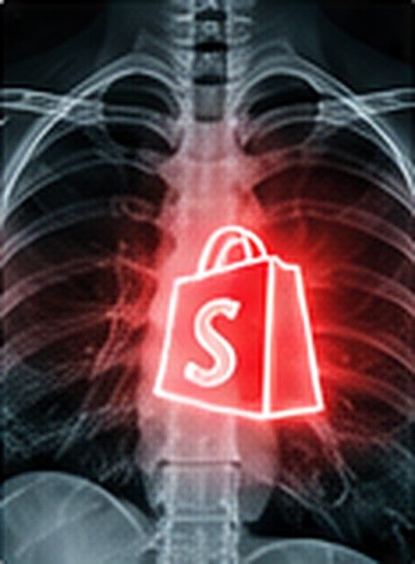X-ray of a store with a glowing red Shopify bag where the heart is